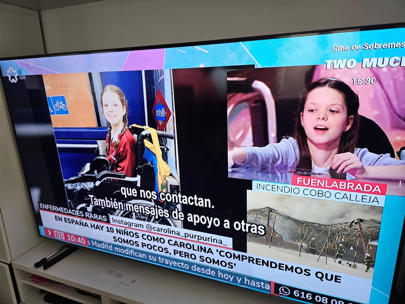 Televisore con un telegiornale sulle malattie rare: una bambina in sedia a rotelle nella metropolitana e un'altra che parla davanti alla telecamera.